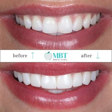 Slider image (8) MBT Dental Pro